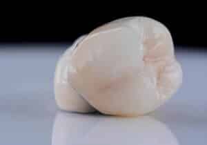 Close up image a porcelain crown, used to correct cosmetic dental issues.